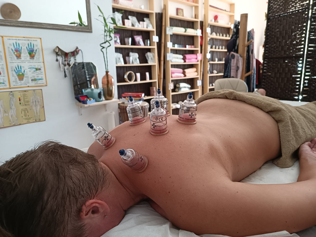 Ventosas o Cupping